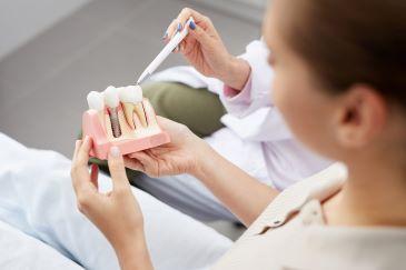 dentist showing a dental implant to a patient in fort lauderdale
