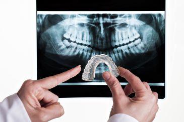 dental x-rays in fort lauderdale
